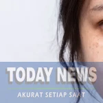 4 Cara Alami Hilangkan Flek Hitam di Wajah