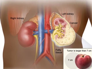 InShot_20260308_101115806